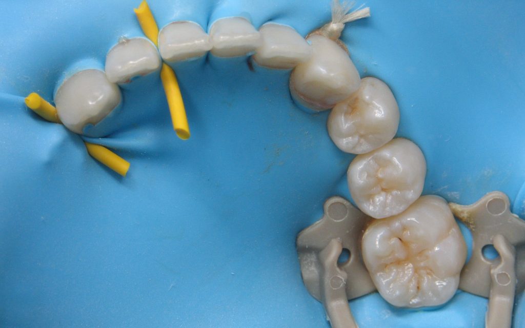 Rubber Dam Course Northwest Dental Academy Dr. Nadeem Younis