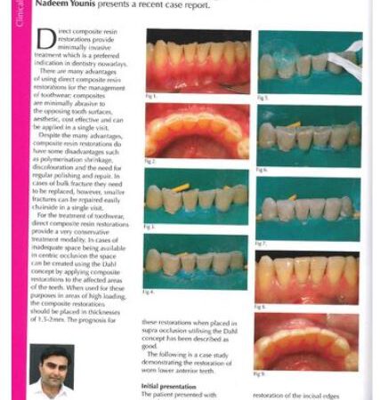 Article 1 — Dr. Nadeem Younis