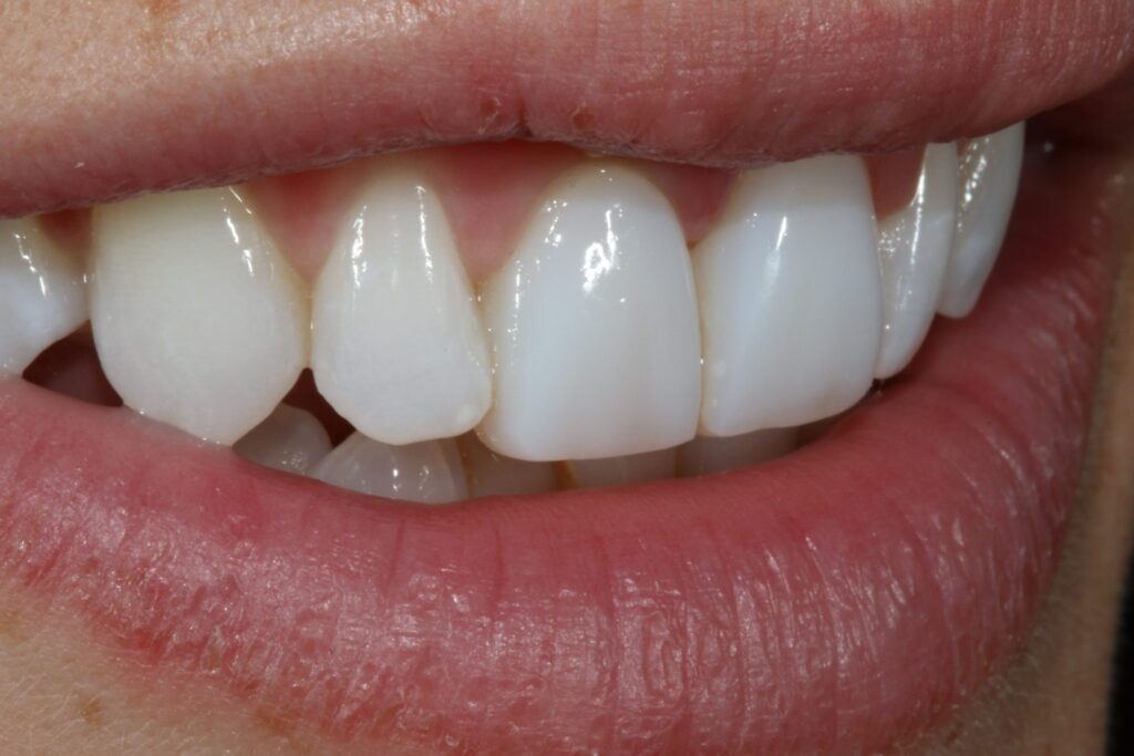 Anterior Composite Masterclass course photo