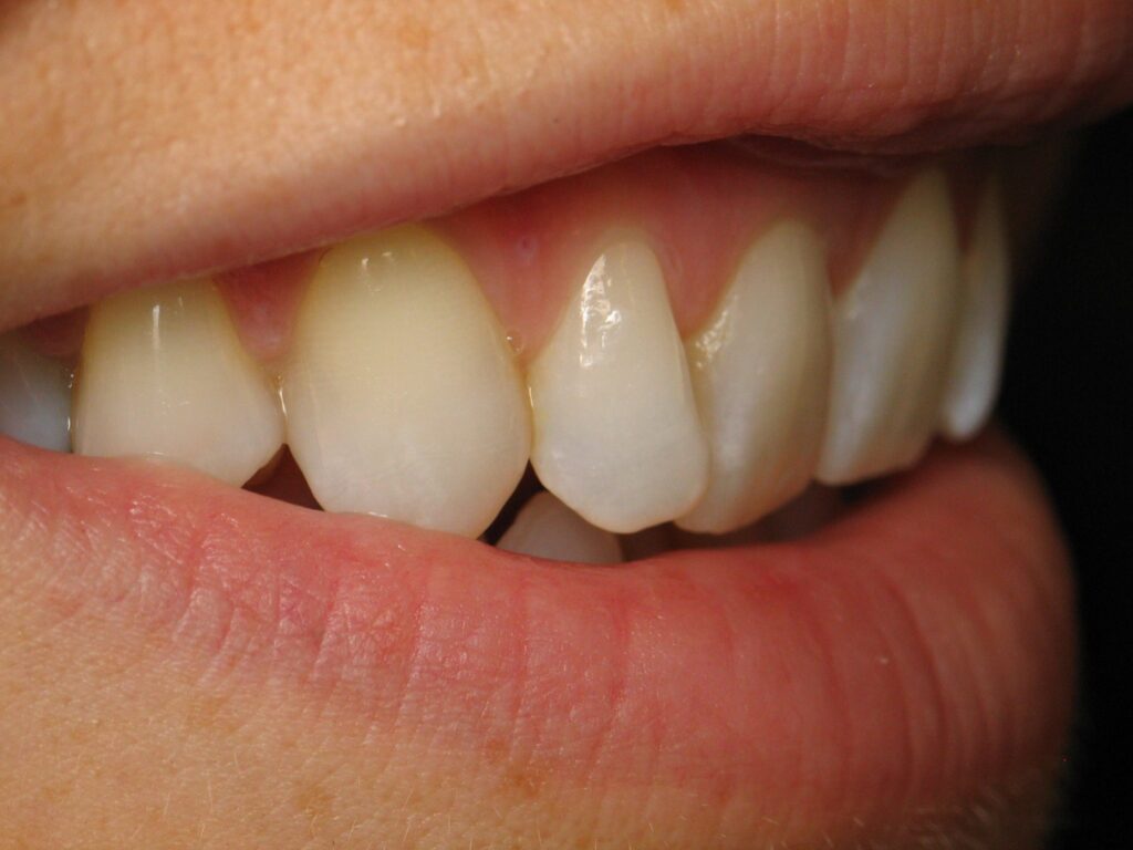 Anterior Composite Masterclass course photo