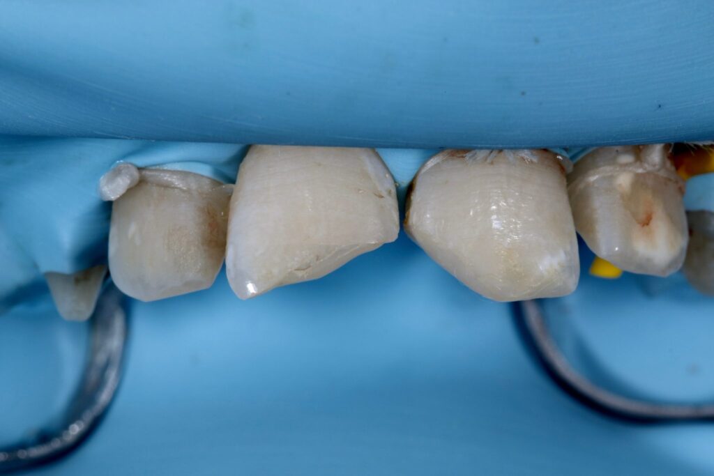 Anterior Composite Masterclass course photo