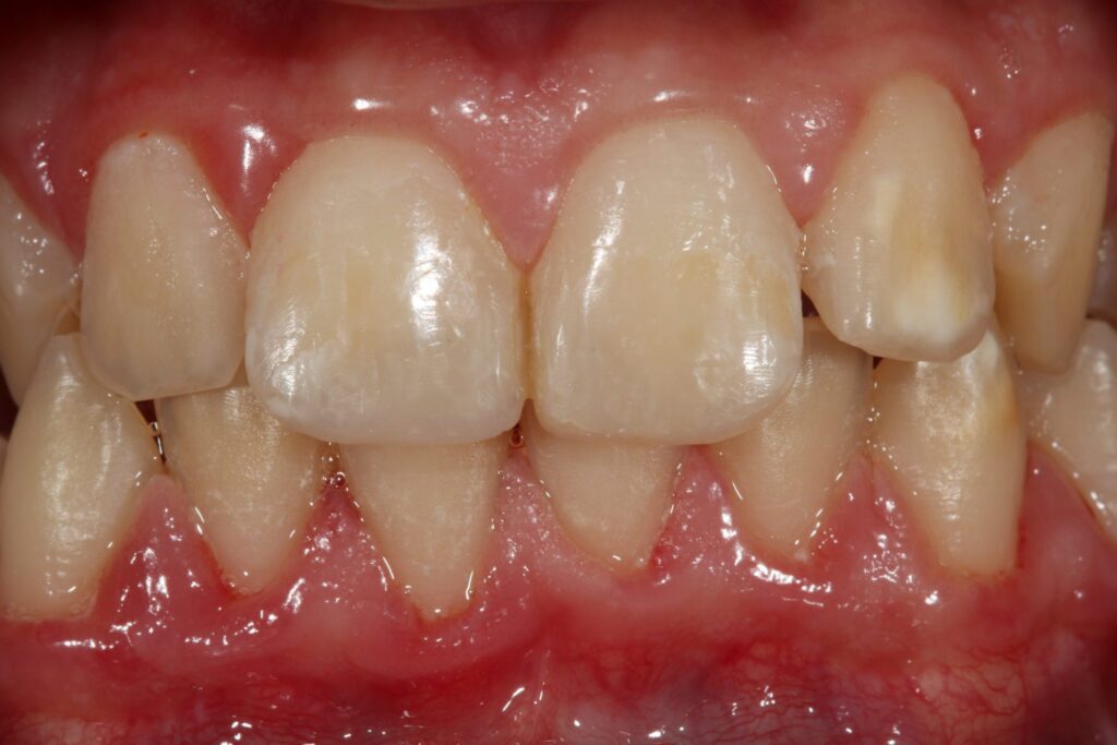 Anterior Composite Masterclass course photo