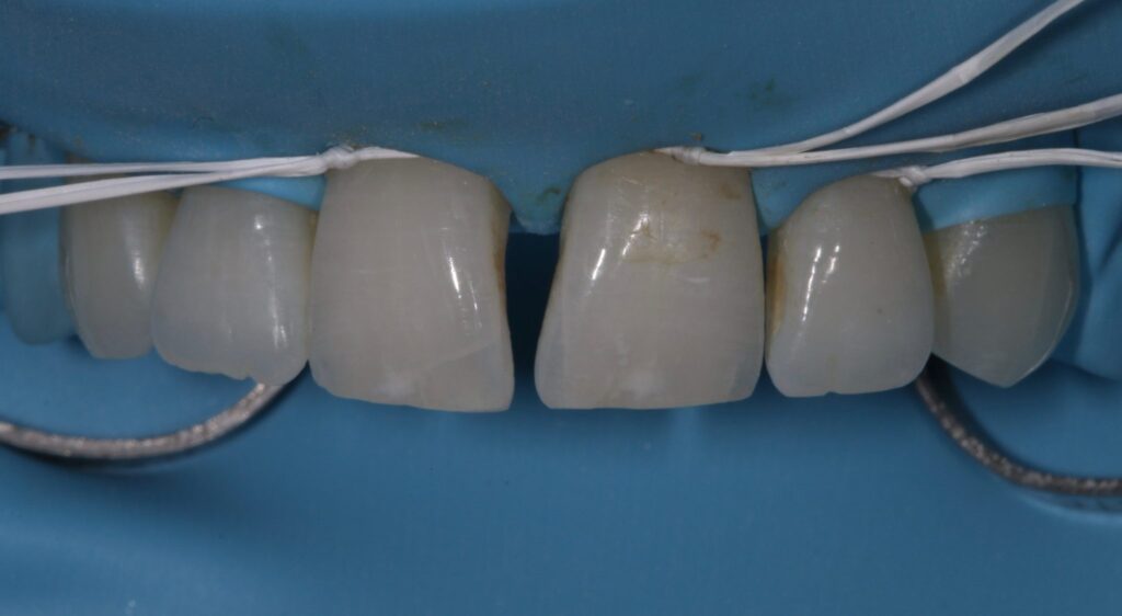 Anterior Composite Masterclass course photo