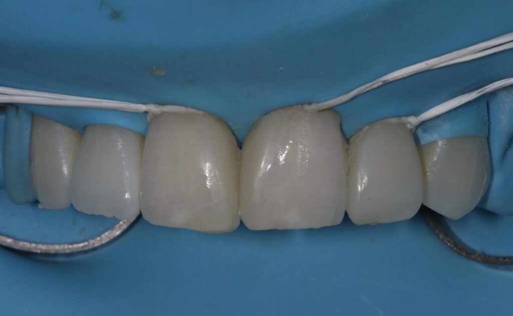 Anterior Composite Masterclass course photo