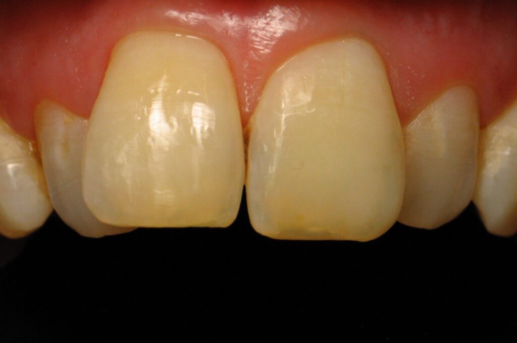 Anterior Composite Masterclass course photo