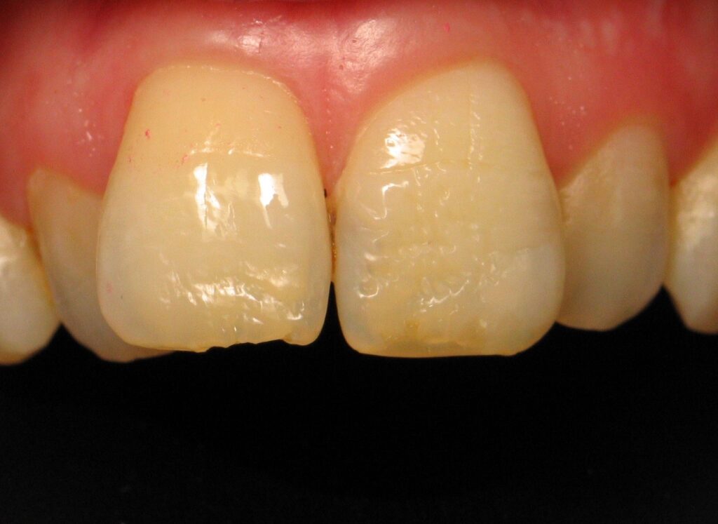 Anterior Composite Masterclass course photo