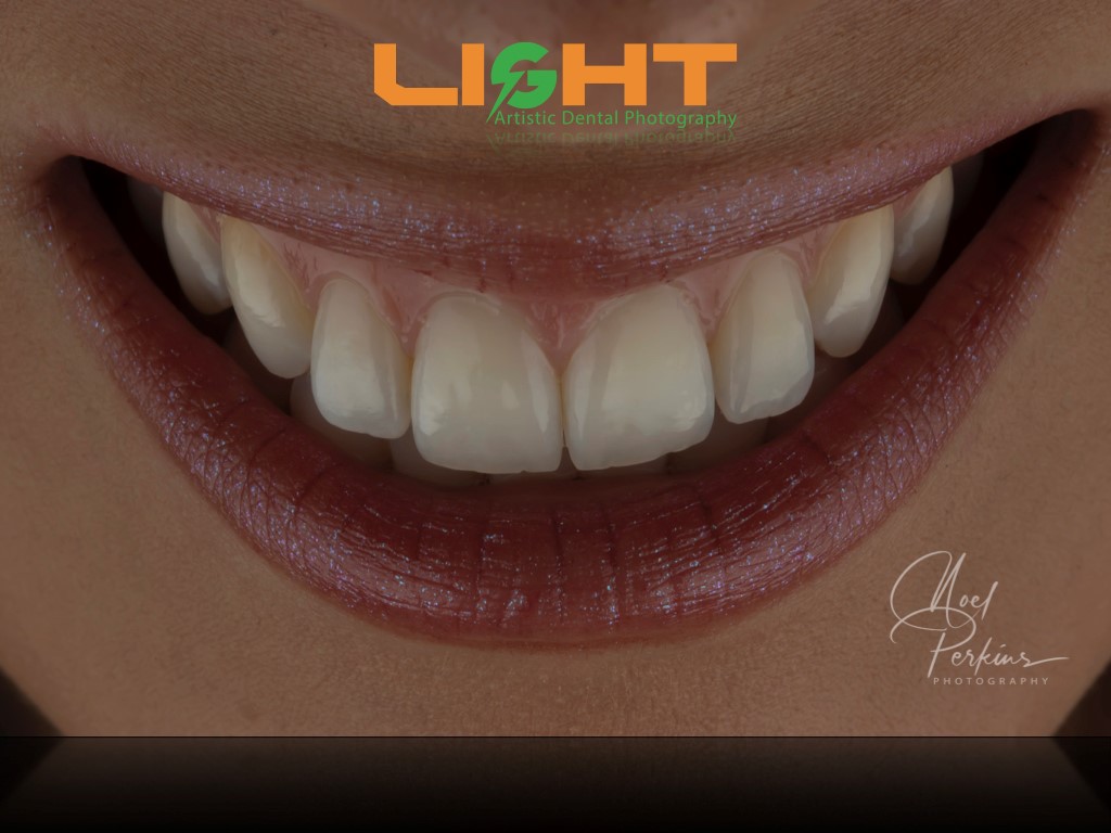 Dental Photography Masterclass course photo