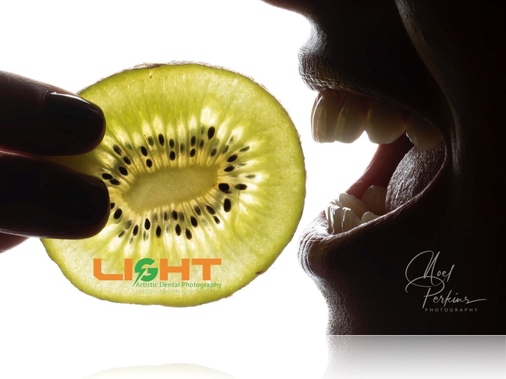 Dental Photography Masterclass course photo