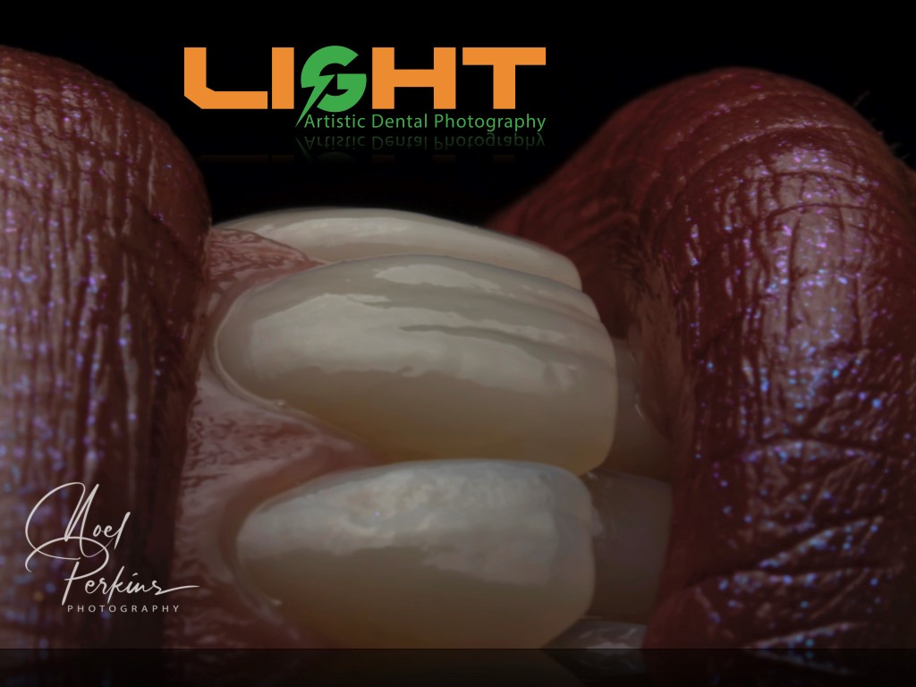 Dental Photography Masterclass course photo