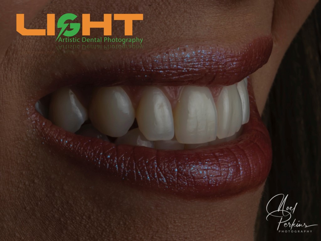 Dental Photography Masterclass course photo