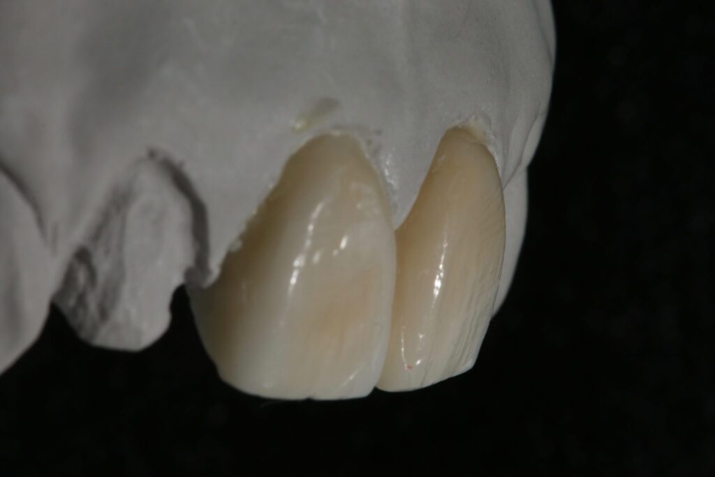 Dental Wax-Up Masterclass course photo