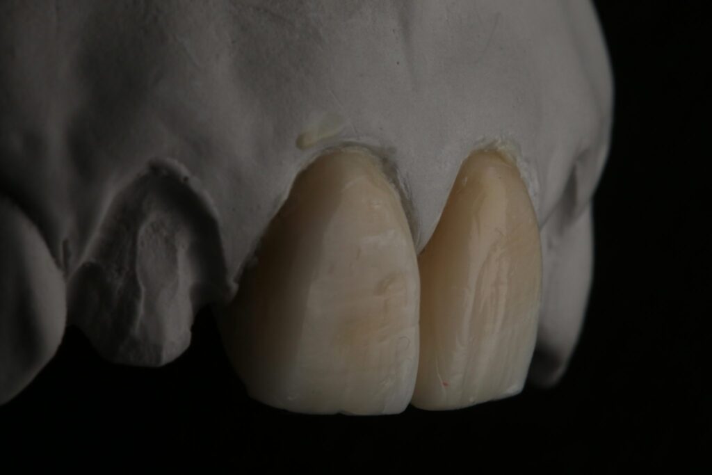 Dental Wax-Up Masterclass course photo