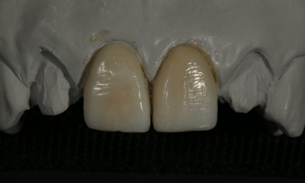 Dental Wax-Up Masterclass course photo