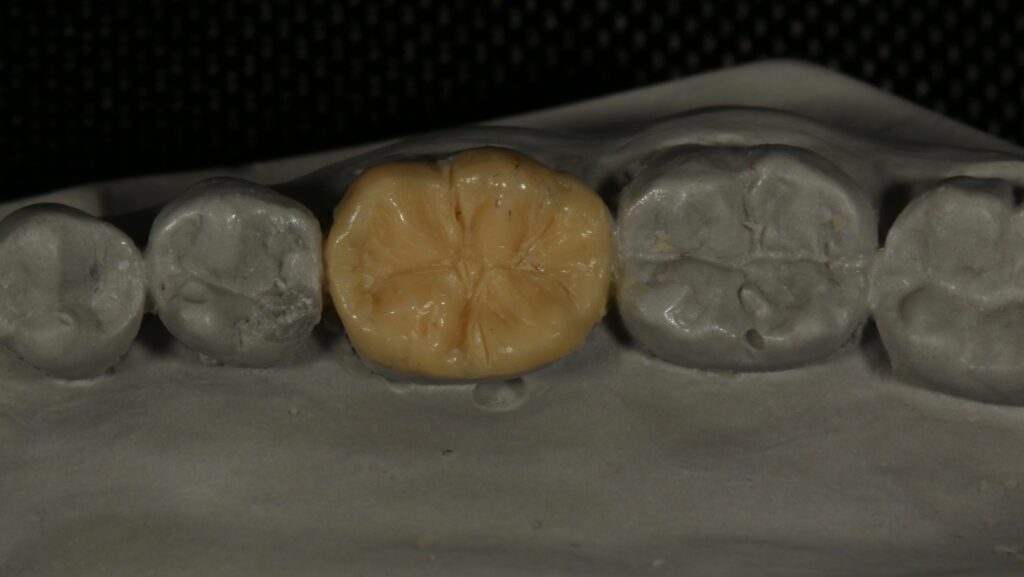 Dental Wax-Up Masterclass course photo