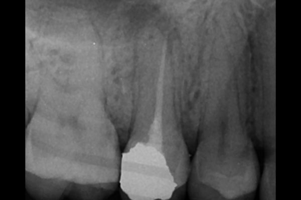 Endodontics Masterclass