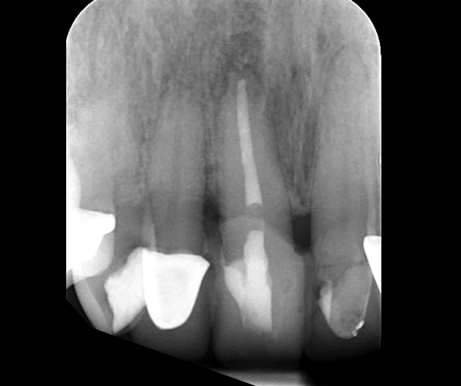 Endodontics Masterclass course photo