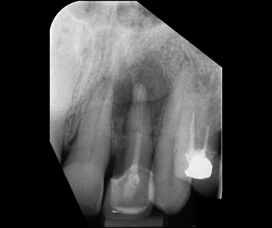 Endodontics Masterclass course photo