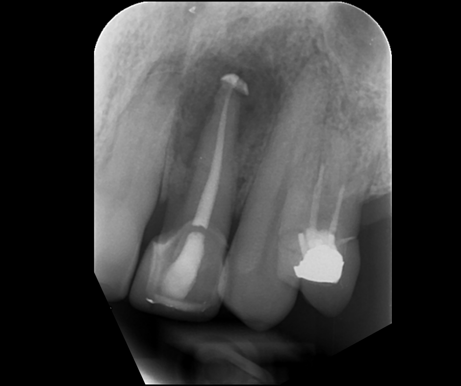 Endodontics Masterclass course photo