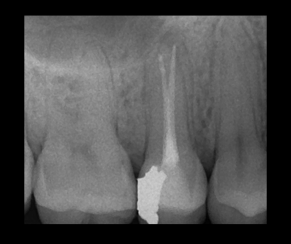 Endodontics Masterclass course photo