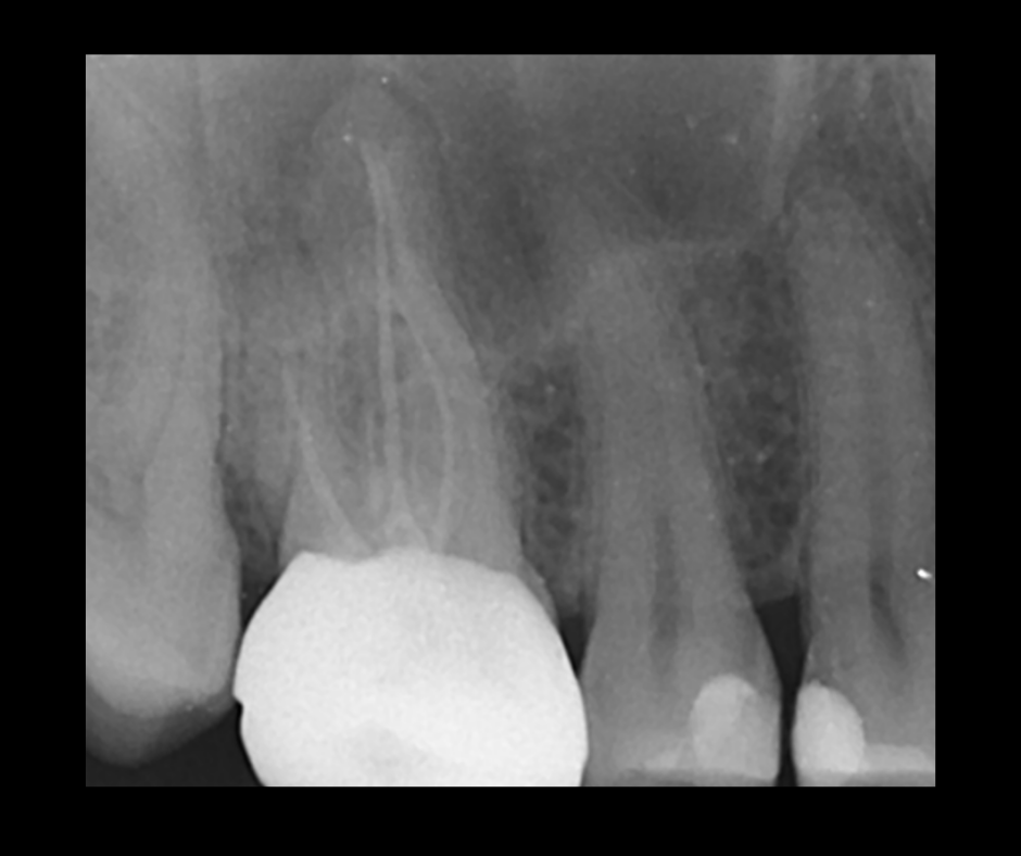 Endodontics Masterclass course photo