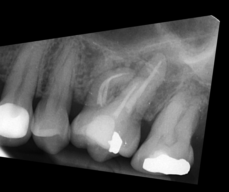 Endodontics Masterclass course photo