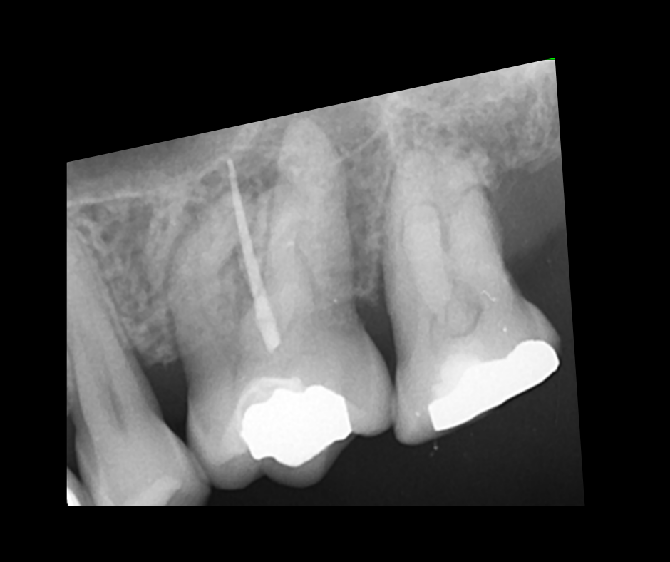 Endodontics Masterclass course photo