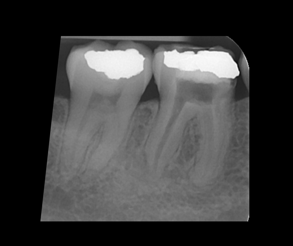Endodontics Masterclass course photo
