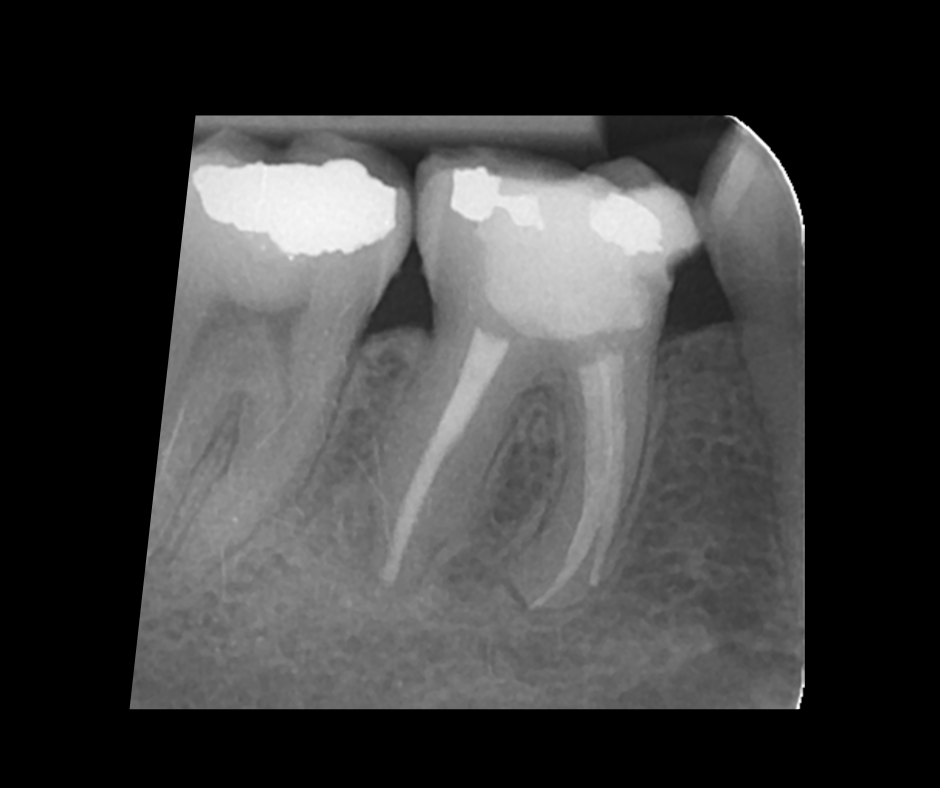 Endodontics Masterclass course photo