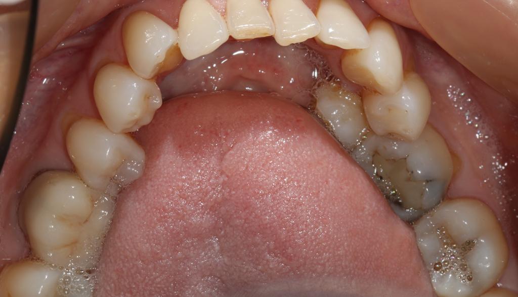 Posterior Composite Masterclass course photo