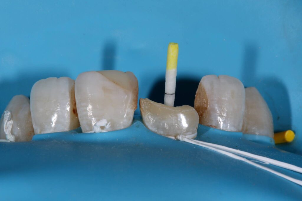 Rubber Dam Masterclass course photo