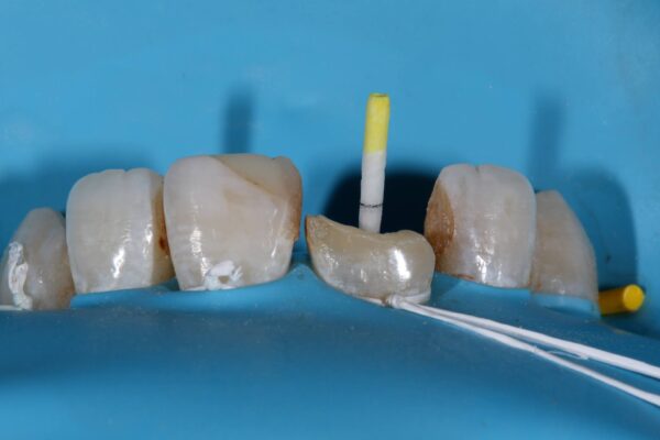 Rubber Dam Masterclass