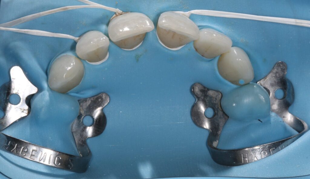 Rubber Dam Masterclass course photo