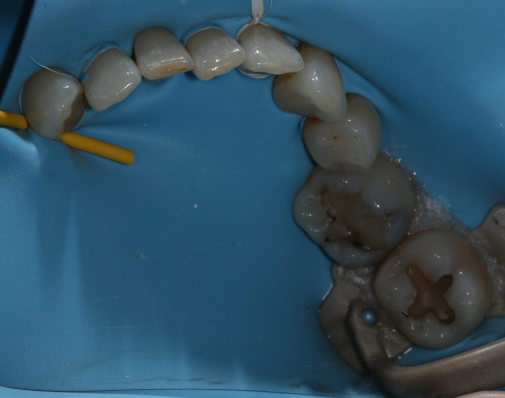 Rubber Dam Masterclass course photo