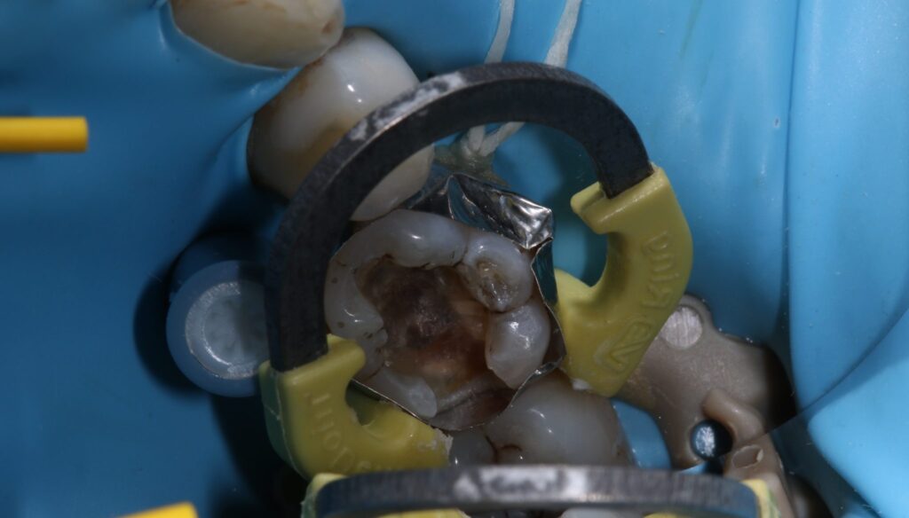 Rubber Dam Masterclass course photo